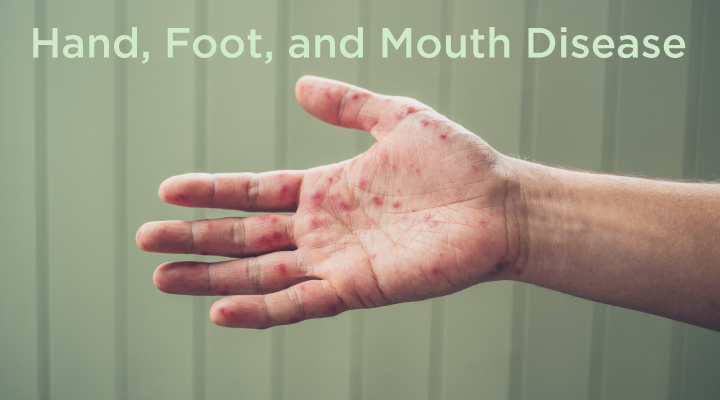 Hand, Foot, and Mouth Disease and Oral Health - Hawaii Dental Service Blog